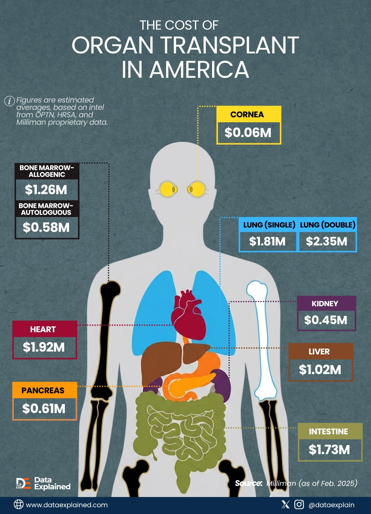 america's organ transplant system cost_DatExplained